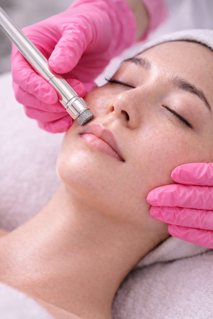 peeling diamante peeling diamante